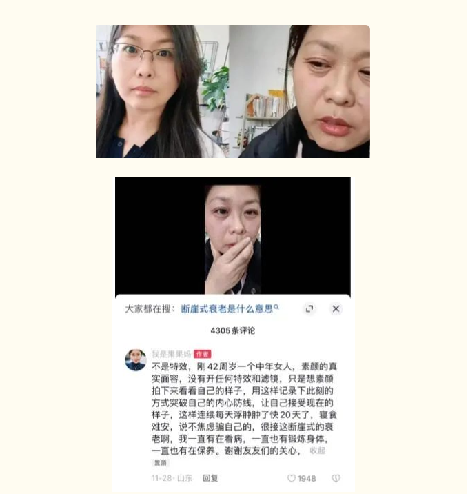 断崖式衰老女子确诊卵巢早衰，生活习惯是衰老“加速器”